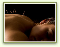Acupuncture Needle